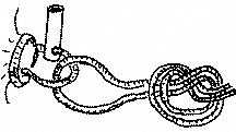 Cord Loop2